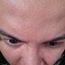 BloodOfTheInsane