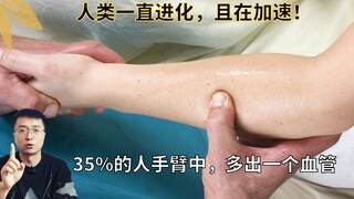 Humans are evolving, and it's accelerating. Scientists have discovered changes in the arms of 35% of