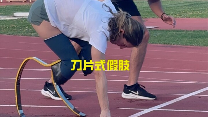 Prostesis jenis bilah membantu penyandang disabilitas mewujudkan impian olahraga mereka!