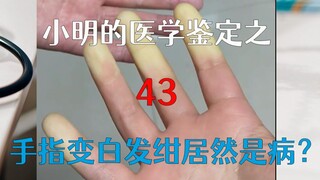 【Xiao Ming】Is palmar cyanosis—a condition where fingers turn pale and bluish—a disease?