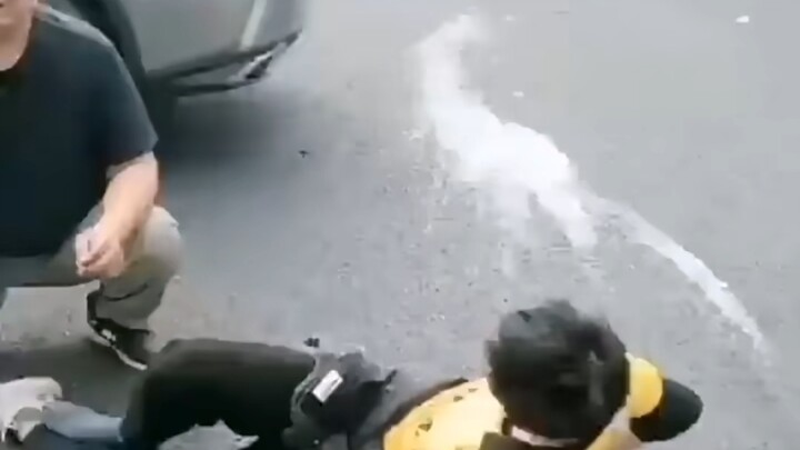 Just looking at it hurts—fractured in the crash!