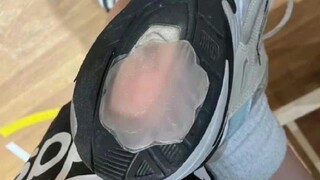 [Stupid comment] What the hell is that on your feet?