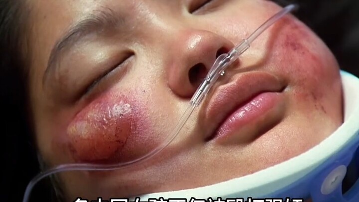 Nhiều cô gái Trung Quốc bị tấn công tình dục có chủ đích, sau đó còn bị tẩy bằng thuốc tẩy! "