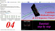 Code Style, Method Groups & US Sequence Viewer -- 3D Slicer Extension Development Tutorial #04
