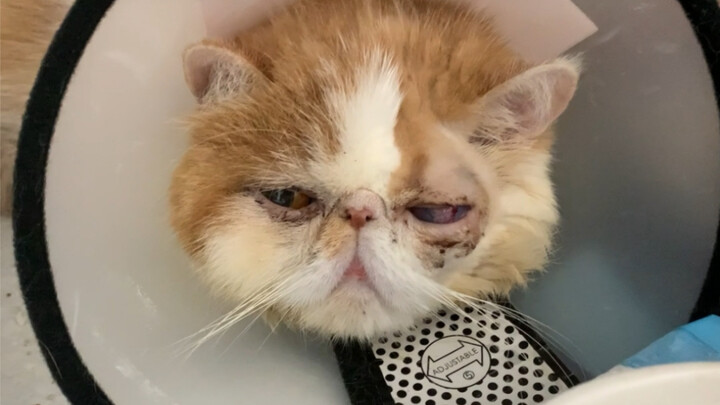 Sutures on the Cornea of the Eye