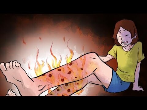 Kakiku Terbakar Dari Dalam