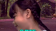 Epol Apple - Parts of the Head