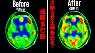 “戒断”多巴胺挑战——7天后，大脑会发生什么变化？