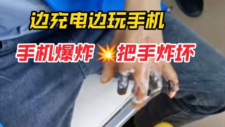 Seorang pria di Guizhou sambil mengisi daya sambil bermain ponsel; saat tertidur, ponselnya meledak 