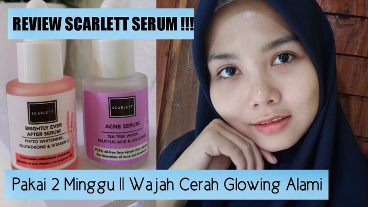 REVIEW SCARLETT SERUM || Acne Serum vs Brightly Ever After Serum || Fara Cahya P