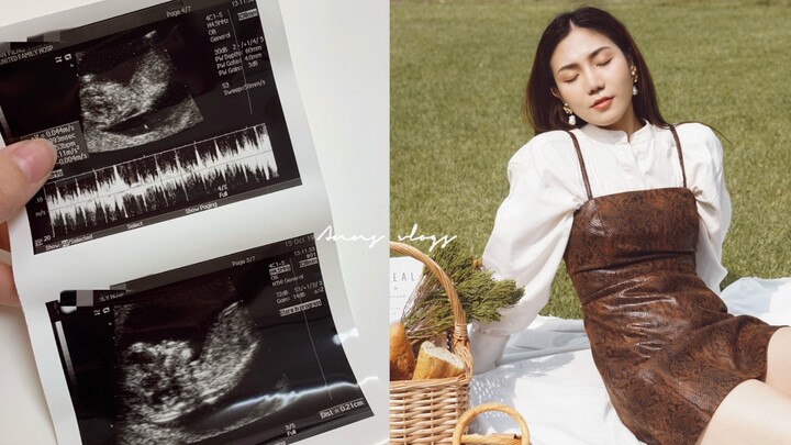ไดอารี่ของแอนน์ #21: เปิดตัวชีวิตเวอร์ชัน 2.0! เหตุผลที่ฉันโพสต์ช้าคืออะไรกันนะ?? | VLOG ประจำสัปดาห