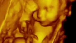 Man who gave birth to his twin brother
