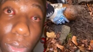 你拉屎的时候一定要看这个视频！