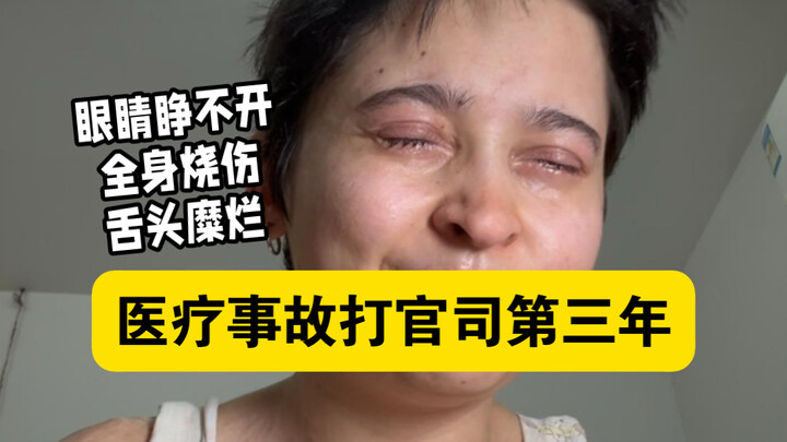 Perkembangan Kasus Luka Bakar Akibat Obat dan Malpraktik Medis (1)