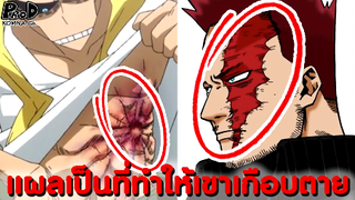 My Hero Academia - ที่มาของแผลเป็นที่ทำให้ฮีโร่เกือบตายได้มายังไง[KOMNA CHANNEL]