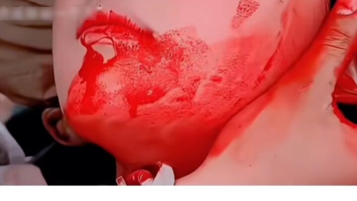 I was really scared by the amount of bleeding.