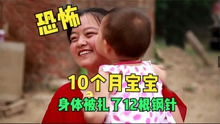 恐怖，10个月大的宝宝，被人刺入12根钢针！