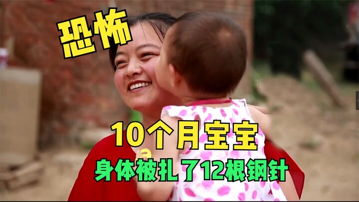 مرعب: طفل عمره 10 أشهر طُعن بـ12 إبرة فولاذية!
