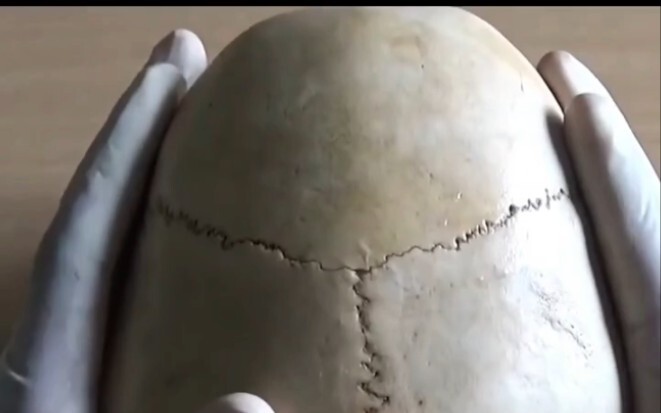 A CPU hidden beneath the skull