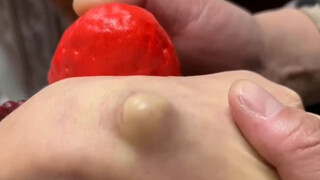 Remove ganglion cyst in seconds
