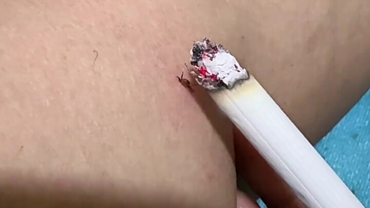 Quá tàn nhẫn! Đốt bọ cánh cứng bằng đầu thuốc lá