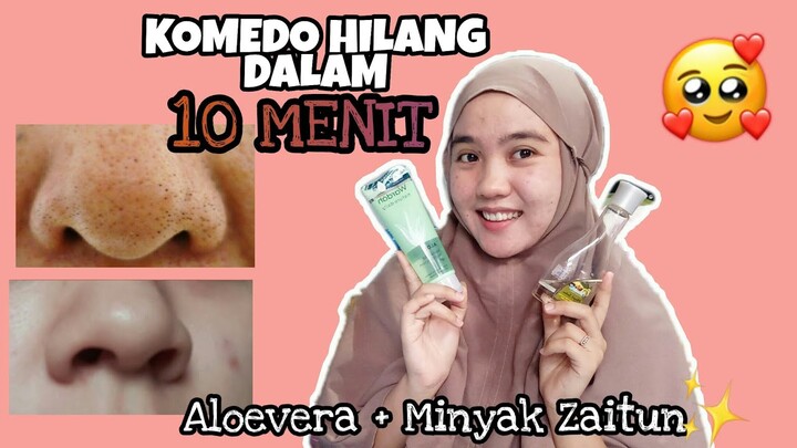 TIPS menghilangkan KOMEDO dalam waktu 10 Menit | Keajaiban Aloevera dan Minyak Zaitun!