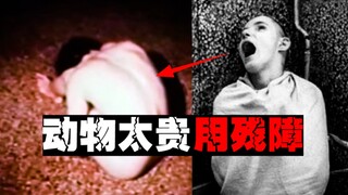 【实验黑历史】用残障进行人体实验，毫无道德底线却服务于普罗大众