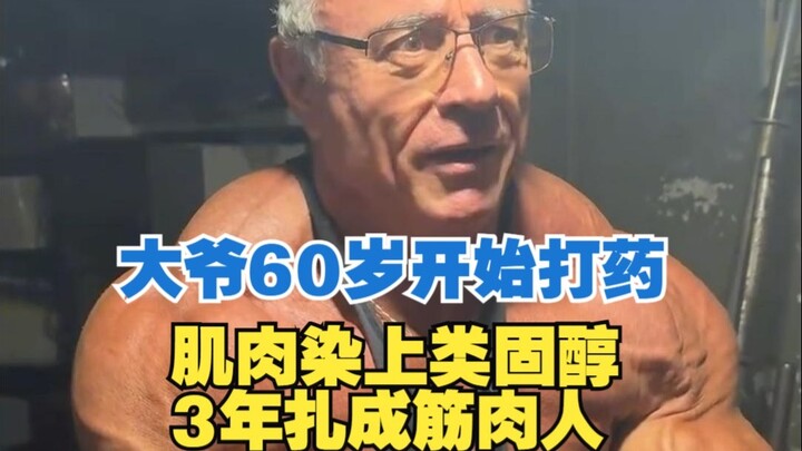 คุณลุงเริ่มใช้สเตียรอยด์ตั้งแต่อายุ 60 ปี กล้ามเนื้อถูกเติมเต็มด้วยสารสเตียรอยด์ ภายใน 3 ปีก็กลายเป็