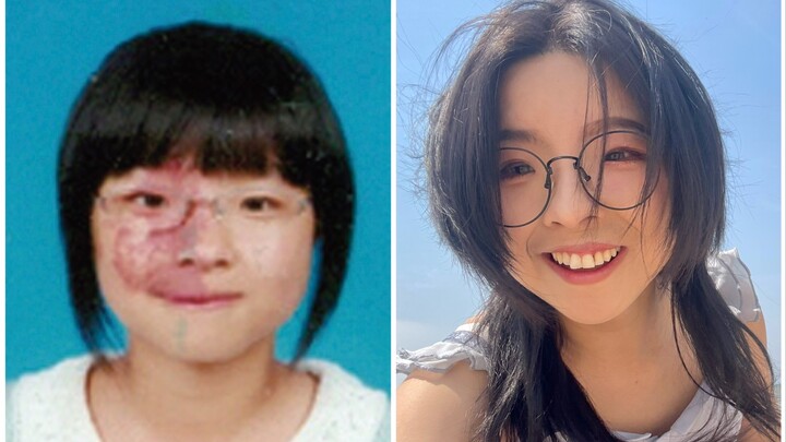 Operasi ganti kepala kecil, kuasai saja!