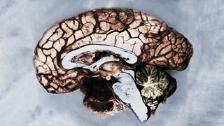 This is what happened to a woman's brain after she applied mercury-containing skin-lightening cream 