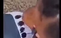 Fetus