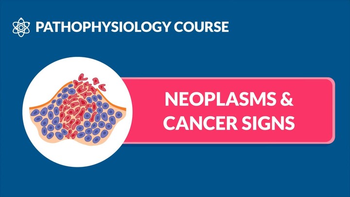 Cancer Signs & Neoplasm