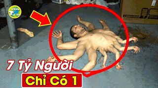 7 Người Có Bộ Phận Cơ Thể Kỳ Lạ và Hiếm Nhất Thế Giới...Tìm 7 Tỷ Người Mới Có 1