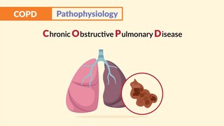 COPD - Emphysema & Chronic Bronchitis (Patho)