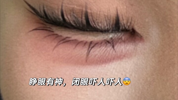 This is the aftereffect of eye enlargement surgery 😂😂