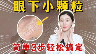 Tiny bumps densely packed around the lips and under the eyes? Here are 3 easy tricks to deal with th