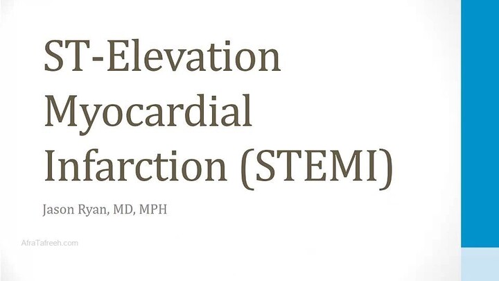 Cardiology - 2. Cardiac Ischemia - 3. STEMI - USMLE step 1