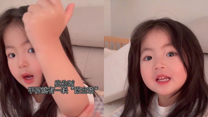 على ذراع الطفلة وحمة زرقاء، وتفسير والدتها أبكى الجميع: "لقد تعرضتُ للضرب فقط لكي أحظى بفرصة أن أكون