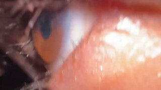 Counterattack 2