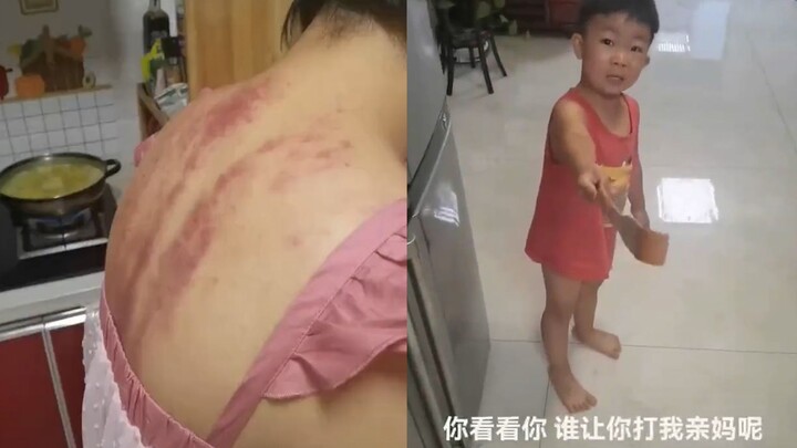 Mẹ vừa cạo gió xong, con tưởng bị bố đánh nên liền cầm đồ định “báo thù”