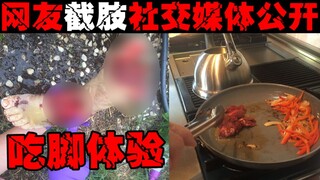 【Makan Bagian Tubuh yang Dipotong】Pria Amerika makan kakinya sendiri yang dipotong, mengundang 10 te