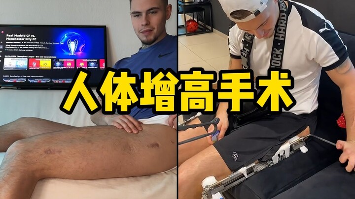 หนุ่มต่างชาติทุ่มเงิน 1 ล้านเพื่อทำให้ตัวเองสูงขึ้น 10 เซนติเมตร