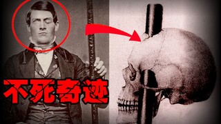 [رجل بقضيب حديدي في رأسه] رجل تم إدخال قضيب حديدي طوله متر واحد في رأسه عن طريق الخطأ، لكنه نجا بأعج