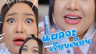 เป็นแผลอย่าเครียด ตัวช่วยมาแล้ว | จือปาก