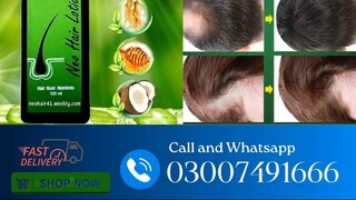 Neo Hair Lotion Same Delivery all In Pakistan | 03007491666