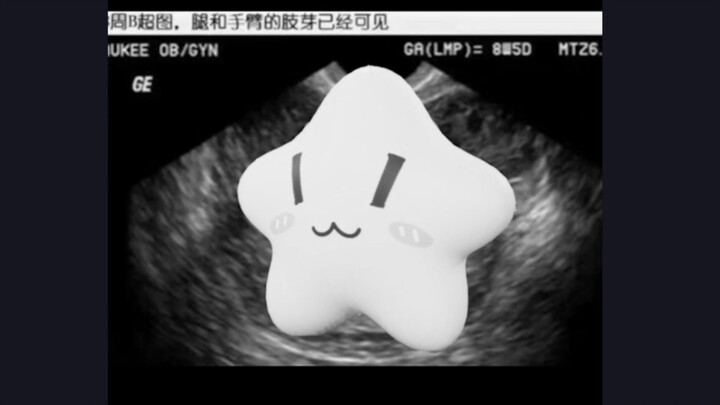 记录第一次怀孕，母子平安（怎么生了个奇怪东西