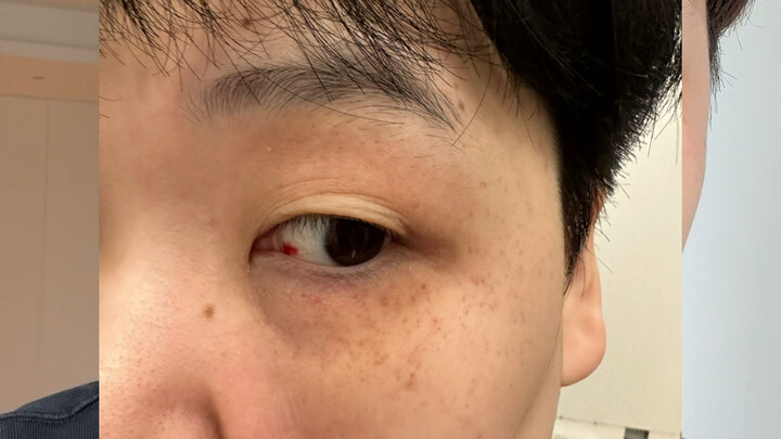 قلل من الأكل!!! البيض المقلي في فوتشو سوياو فنغ للدليفري!!! آه!!!