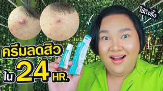 รีวิวก่อนใคร! ครีมลดสิว Uderma ใช้จริงใน 24 ชั่วโมง! ลดจริงหรือจกตา?  จือปาก