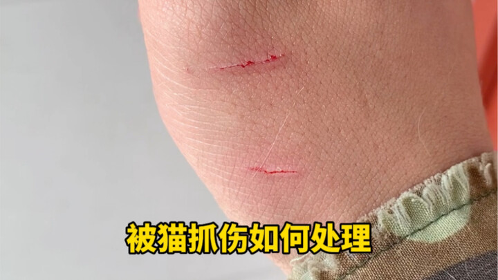 What to Do If You Get Scratched by a Cat