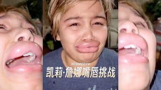 Mom! I've turned into Kylie Jenner!